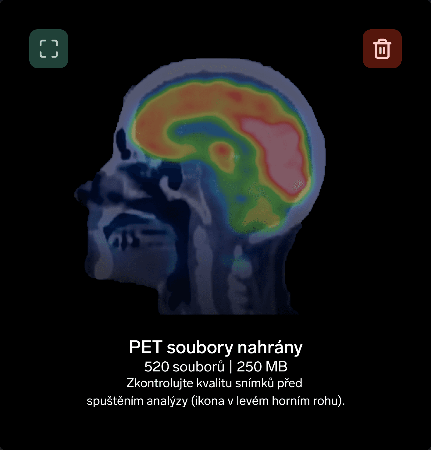 Neurona scan brain 2