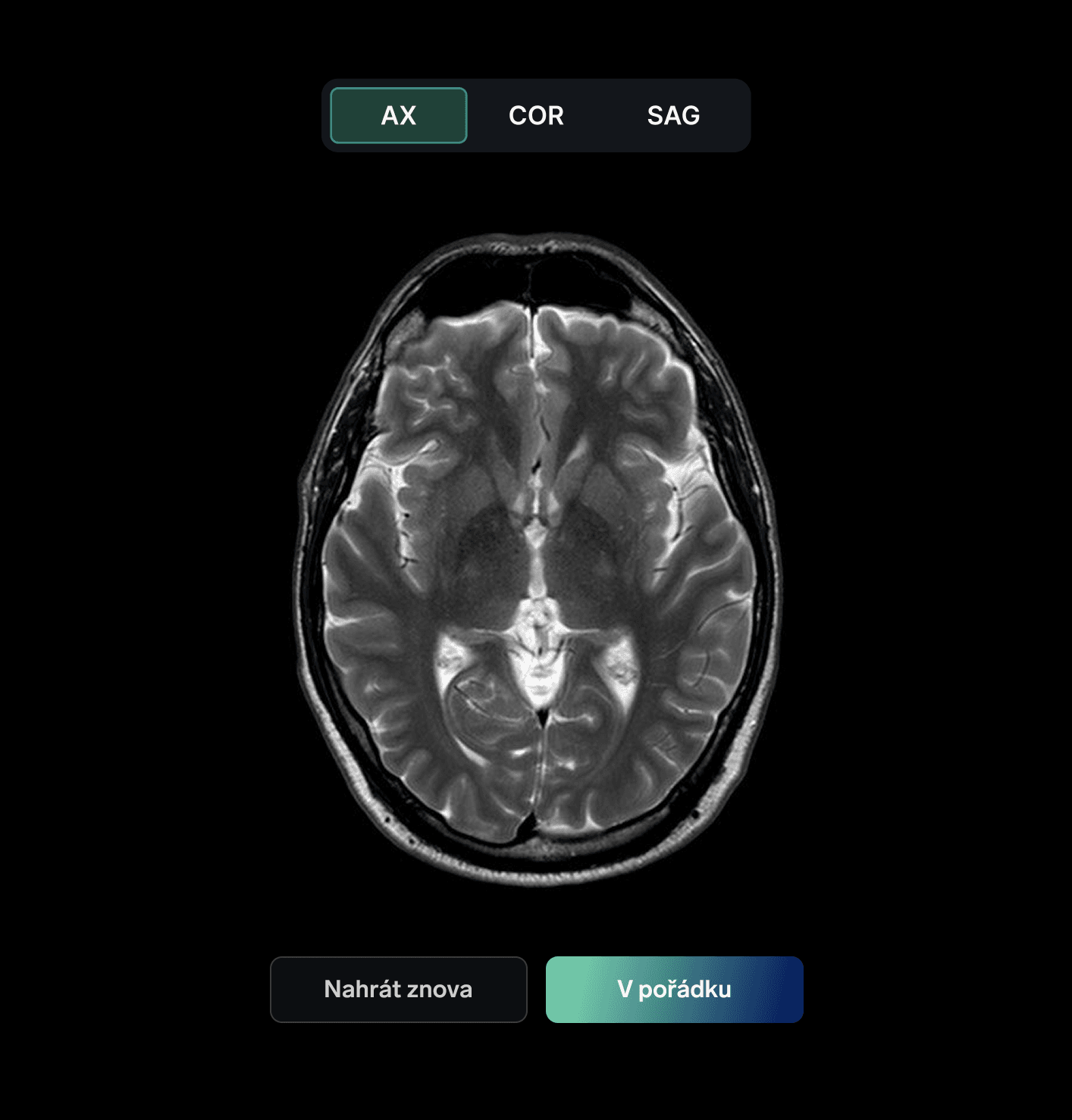 Neurona scan brain