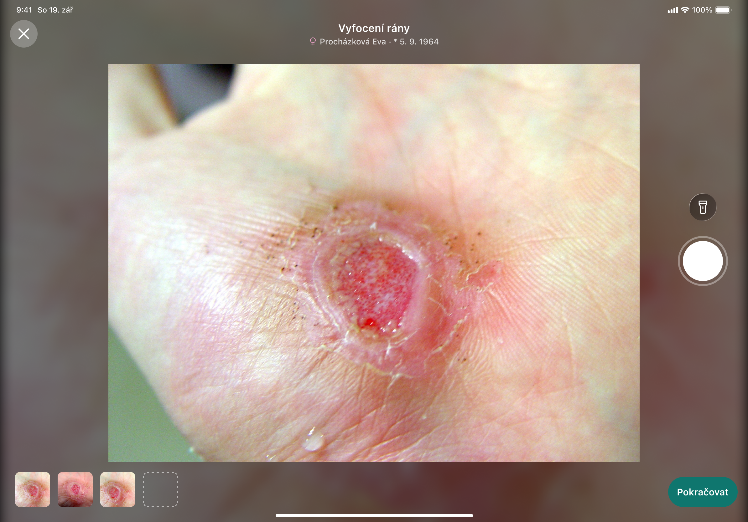 Ansora Vulna wound photography interface with captured-image thumbnails.